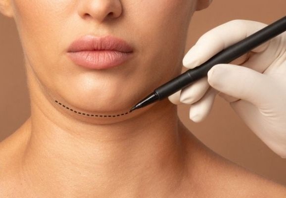 Megan Double Chin Reshape